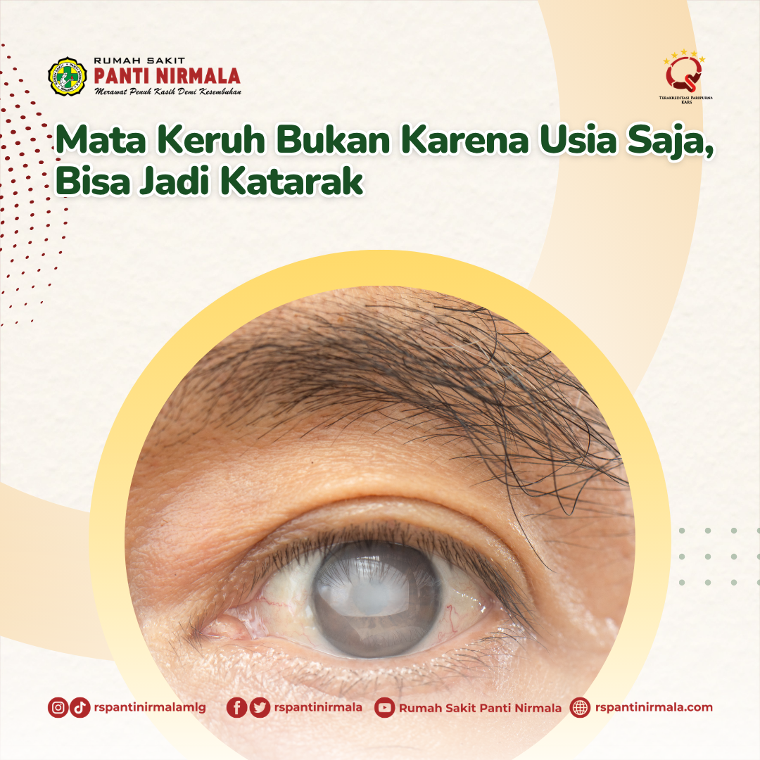 Mata Keruh Bukan Karena Usia Saja, Bisa Jadi Katarak