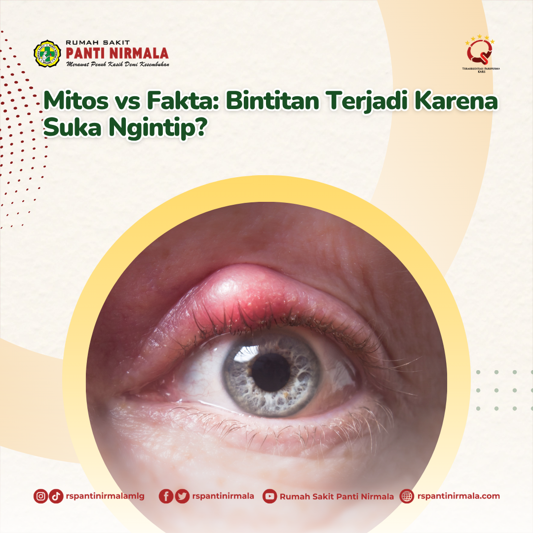 Mitos vs Fakta: Bintitan Terjadi Karena Suka Ngintip?