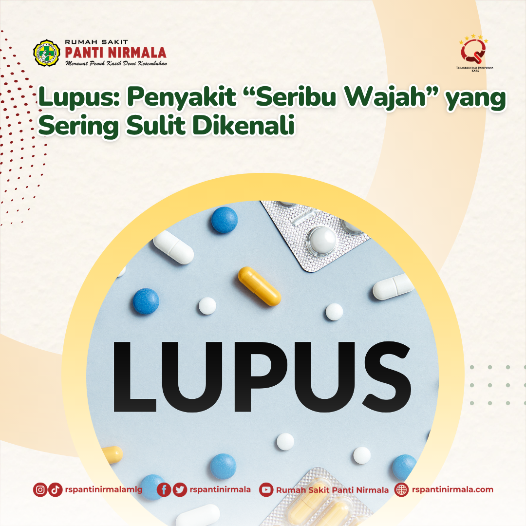 Lupus: Penyakit “Seribu Wajah” yang Sering Sulit Dikenali